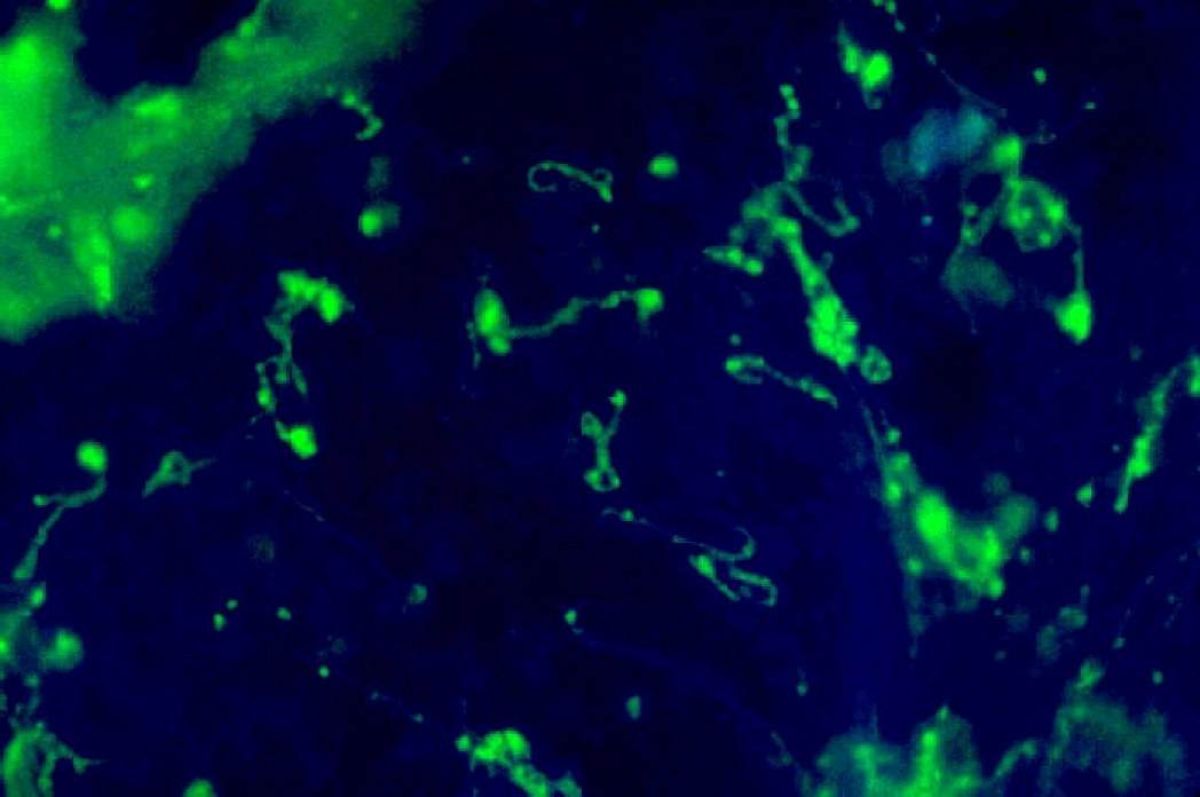 лептоспироз собак патанатомия. печень и вирус коронавируса. темнопольная микроскопия трепонем. бактерии печени. раковая клетка печени человека.