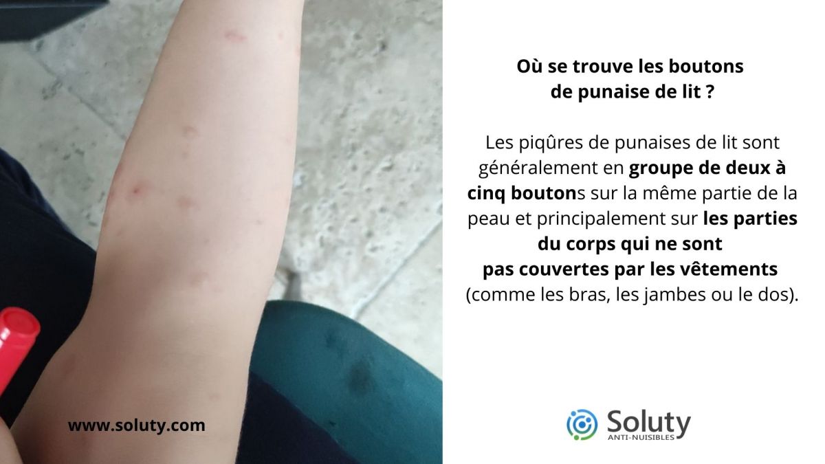 Où se trouve les boutons de punaise de lit ?